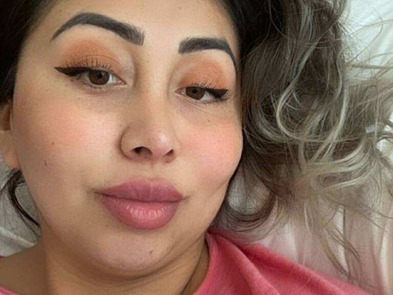 ¡Se hizo de nuevo! Naya Fácil se sometió a más de cuatro cirugías en su viaje a Colombia