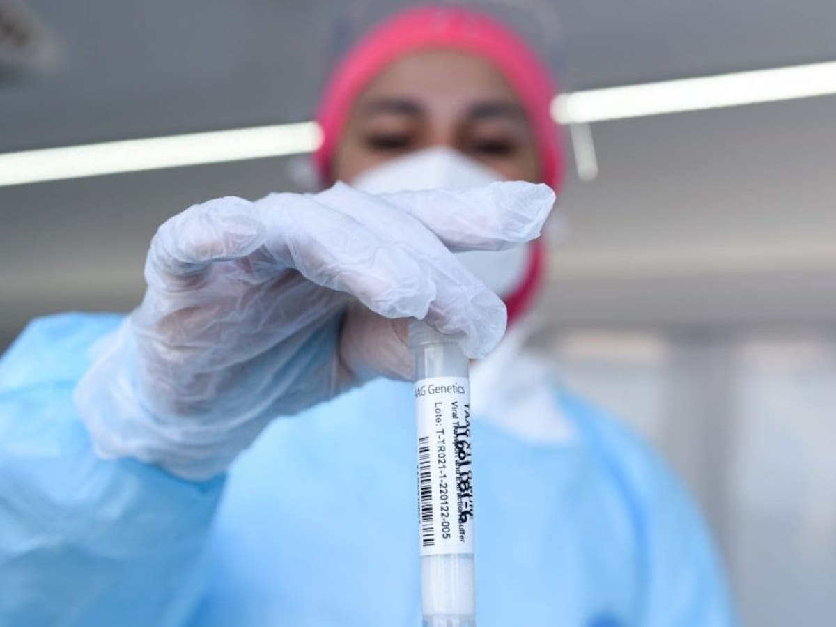 Balance covid del 21 de julio: nuevos contagios descienden en un 17%, pero hay 70 fallecidos