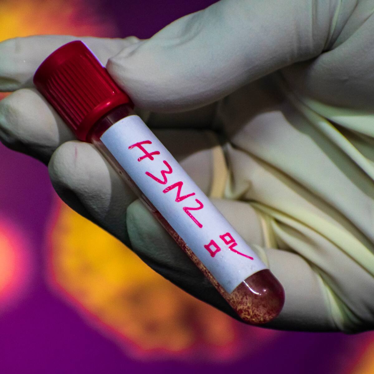 Alerta internacional por “súper gripe H3N2”: estos son los síntomas que debes reconocer