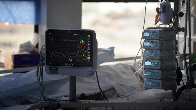 22 de JUNIO de 2020/VALPARAISOPaciente en la unidad de cuidados intensivos COVID-19 (UCI) en el hospital Carlos Van Buren a una semana de la cuarentena total por la pandemia coronavirus que vive el país
FOTO: PABLO OVALLE ISASMENDI/AGENCIAUNO