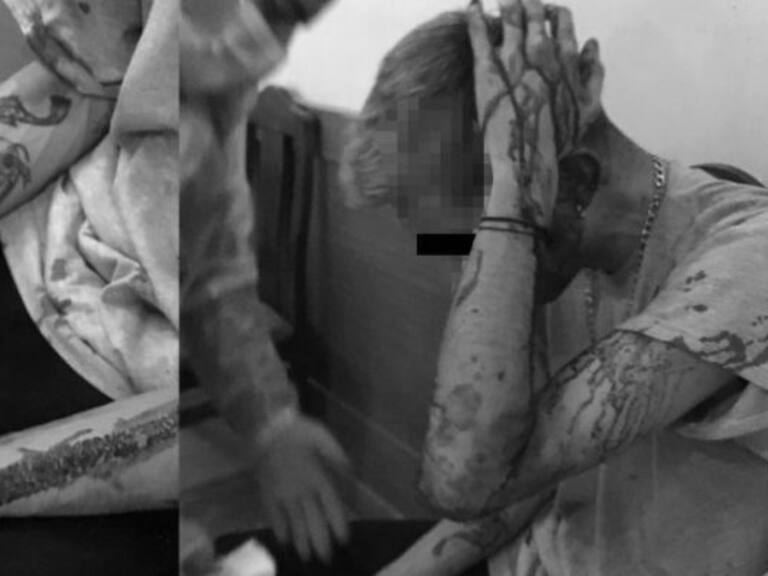 Movilh denunció violento ataque a jóvenes en restaurante de Providencia: agredido terminó con fracturas y cortes