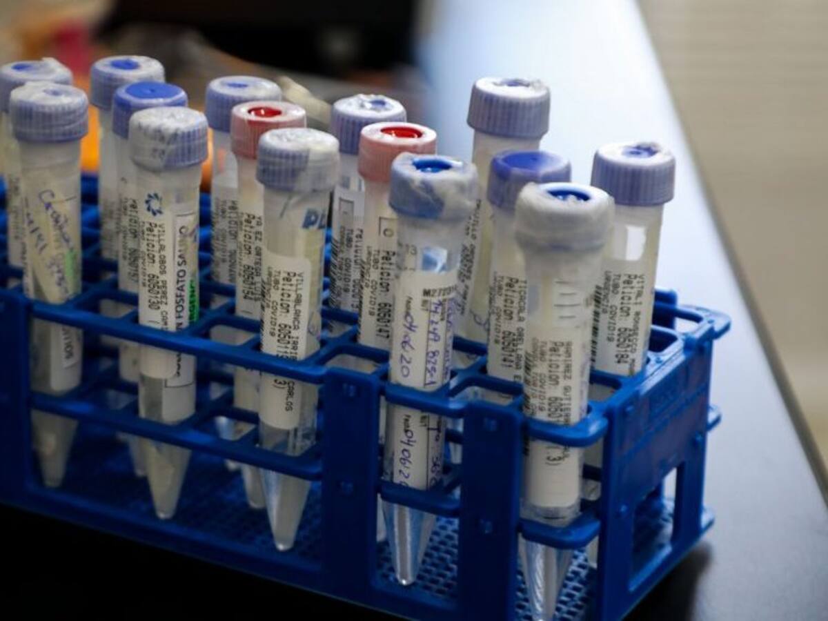 Ministerio de Salud descartó la contaminación de muestras PCR en la Región de Magallanes