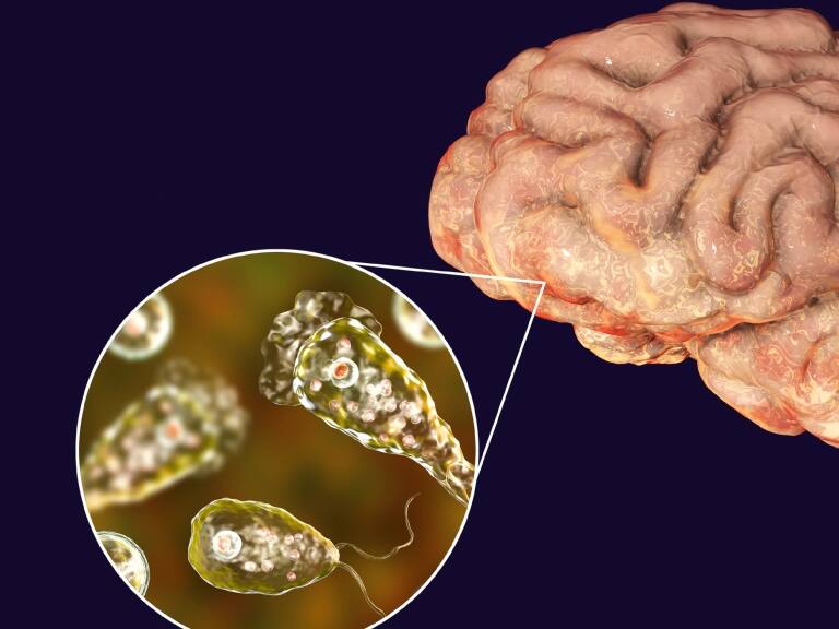 Estados Unidos: niño de 2 años fallece producto de una ameba «come cerebros»
