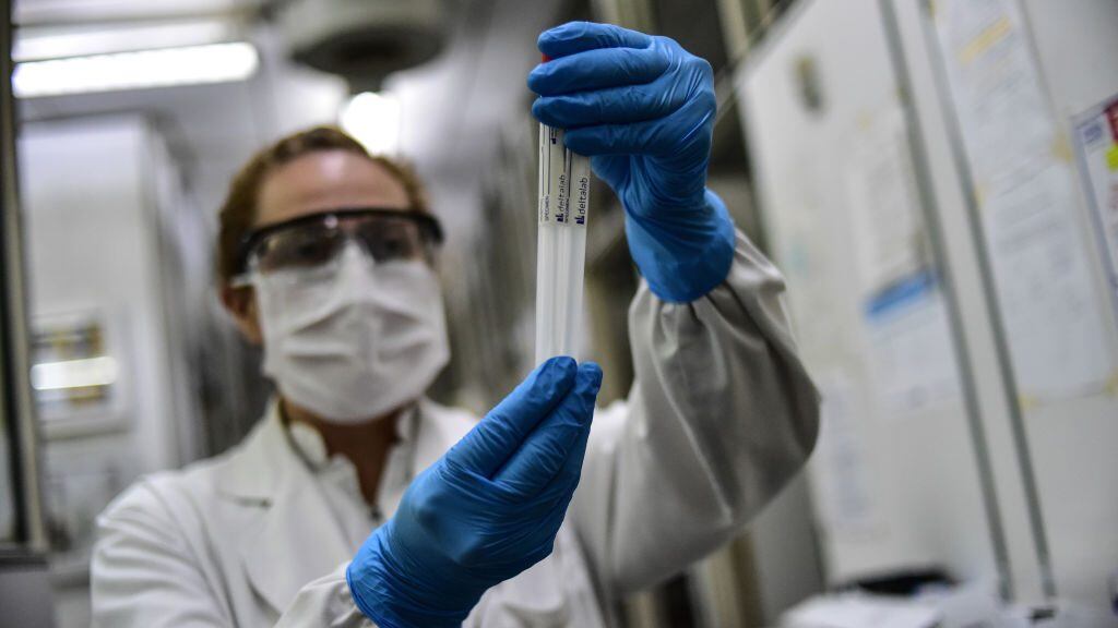 BUENOS AIRES, ARGENTINA - APRIL 28: Biochemist Daniela Beatriz Ori manipulates swab samples to make a real time polymerase chain reaction (RT-PCR) analysis for COVID-19 testing at the biochemistry lab of Central Navy Hospital Dr. Pedro Malloon April 28, 2020 in Buenos Aires, Argentina. The hospital, which is treating COVID-19 patients, has capacity to process up to 36 swab samples a day. (Photo by Amilcar Orfali/Getty Images)