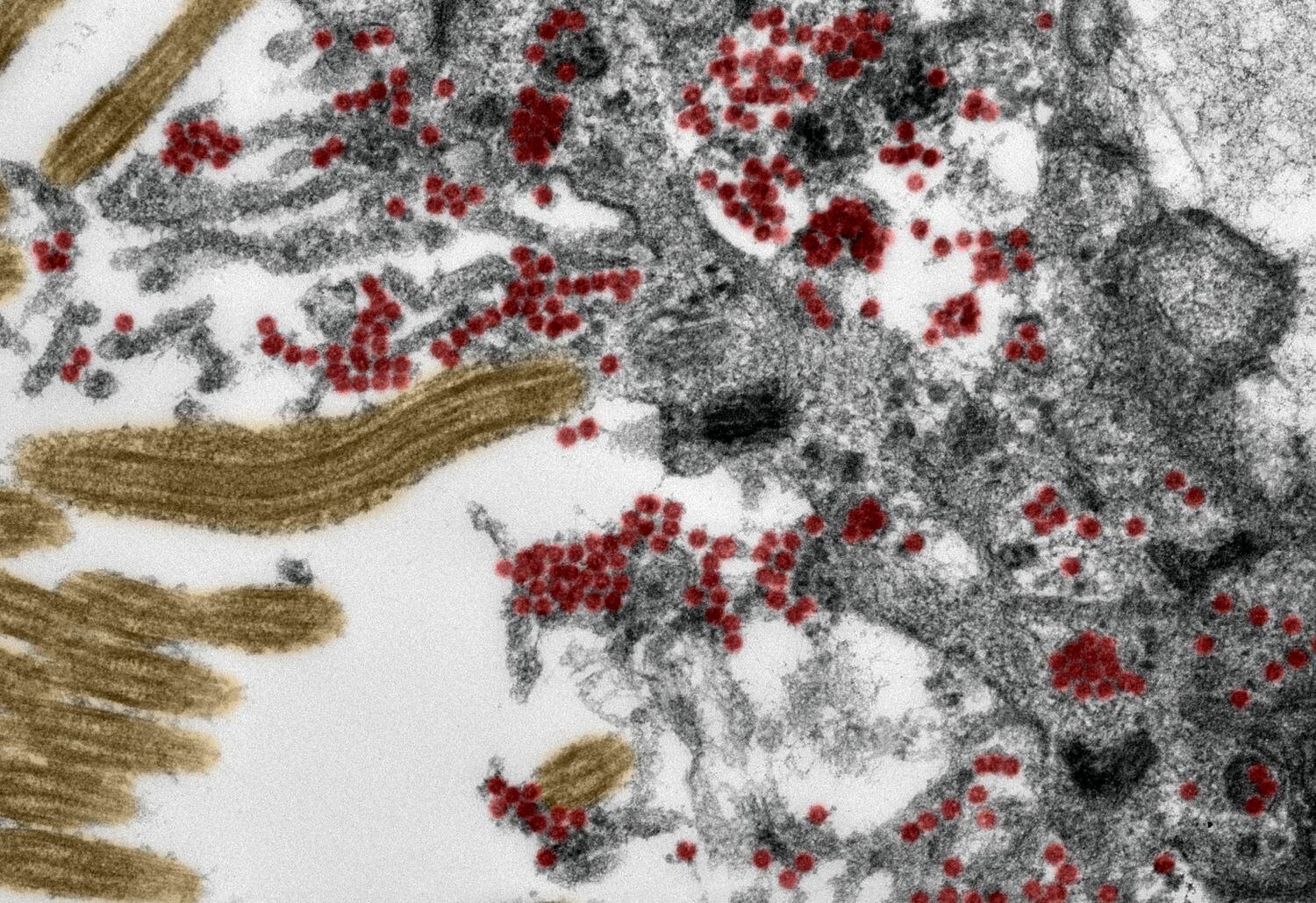 Célula de la mucosa olfativa en microscopio electrónico y en rojo las partículas del Covid-19