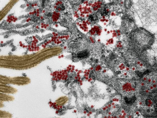 Célula de la mucosa olfativa en microscopio electrónico y en rojo las partículas del Covid-19