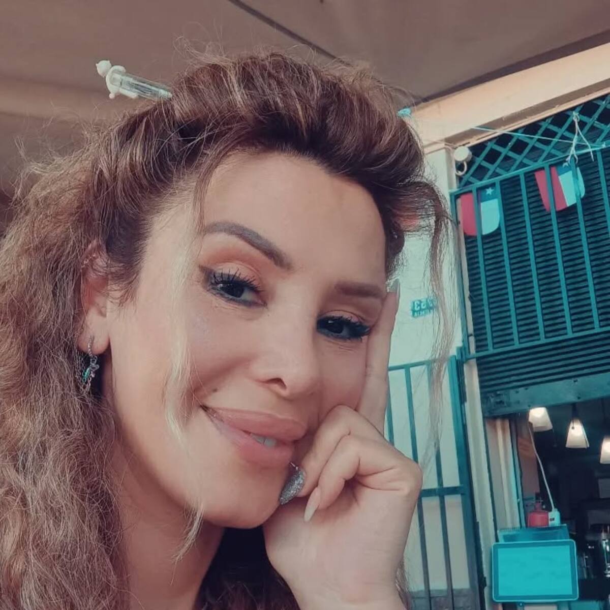 “Oren por mí”: Romina Sáez comparte impactante imagen de su rostro desfigurado en inicio de juicio por “lesiones graves”