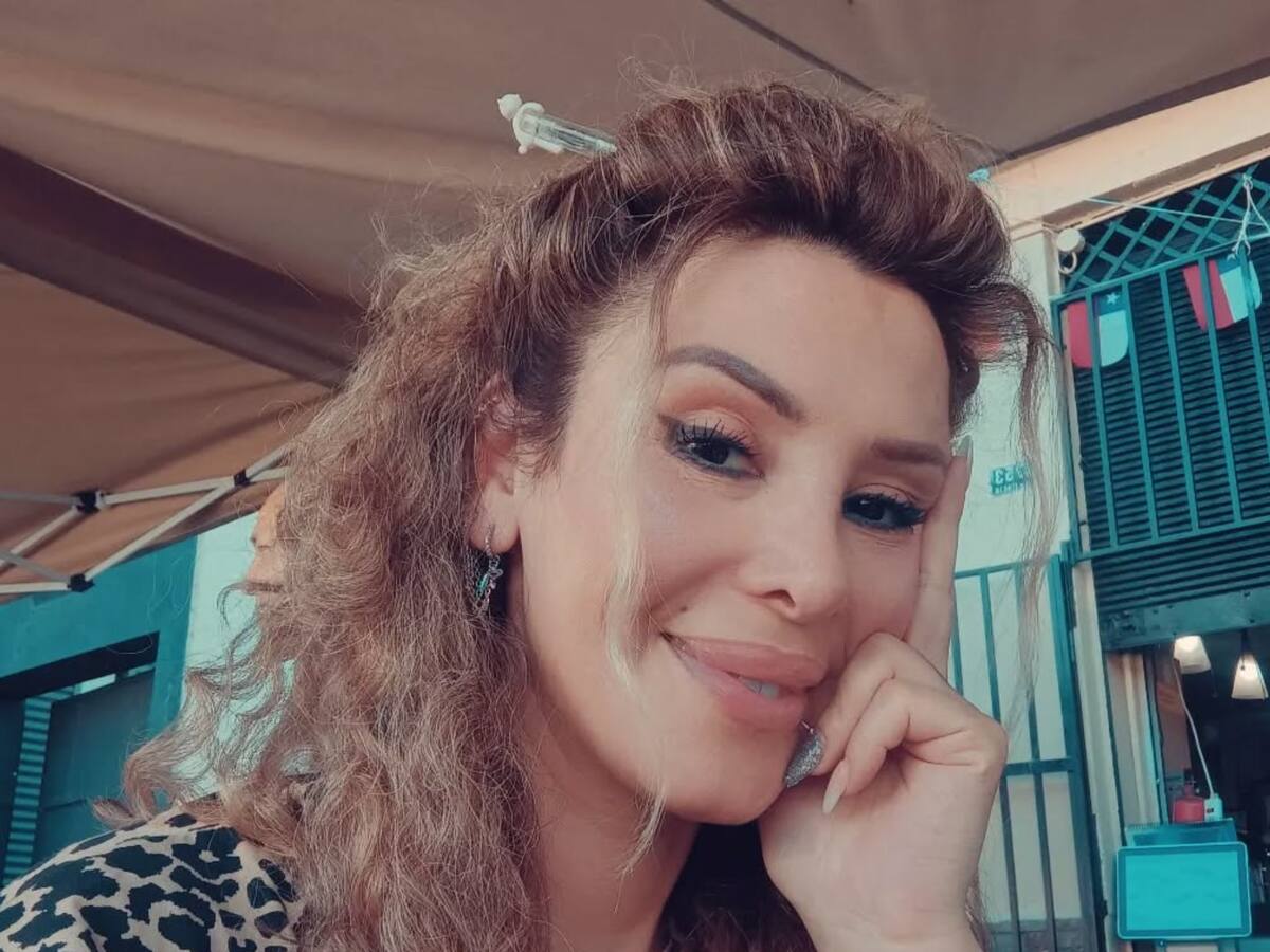“Oren por mí”: Romina Sáez comparte impactante imagen de su rostro desfigurado en inicio de juicio por “lesiones graves”