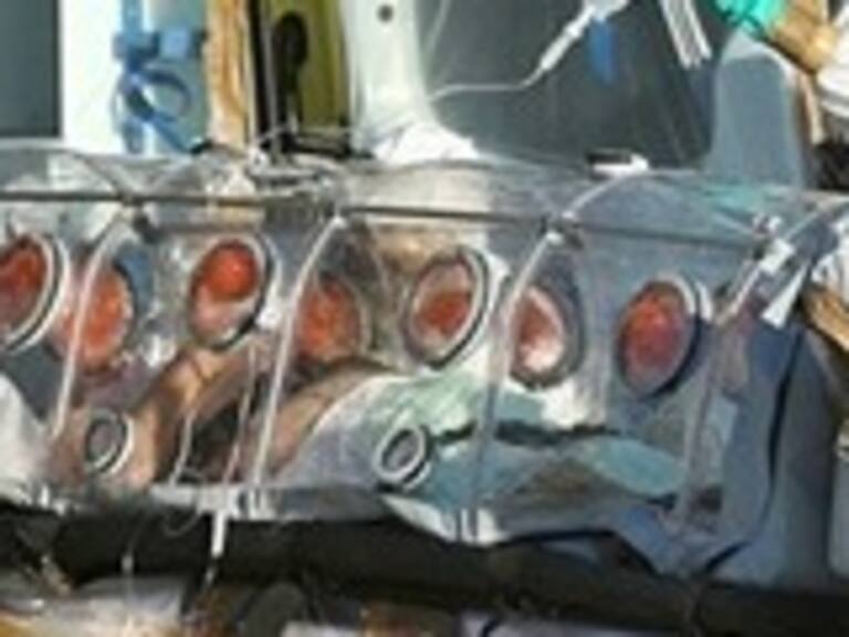 Falleció sacerdote español contagiado con ébola