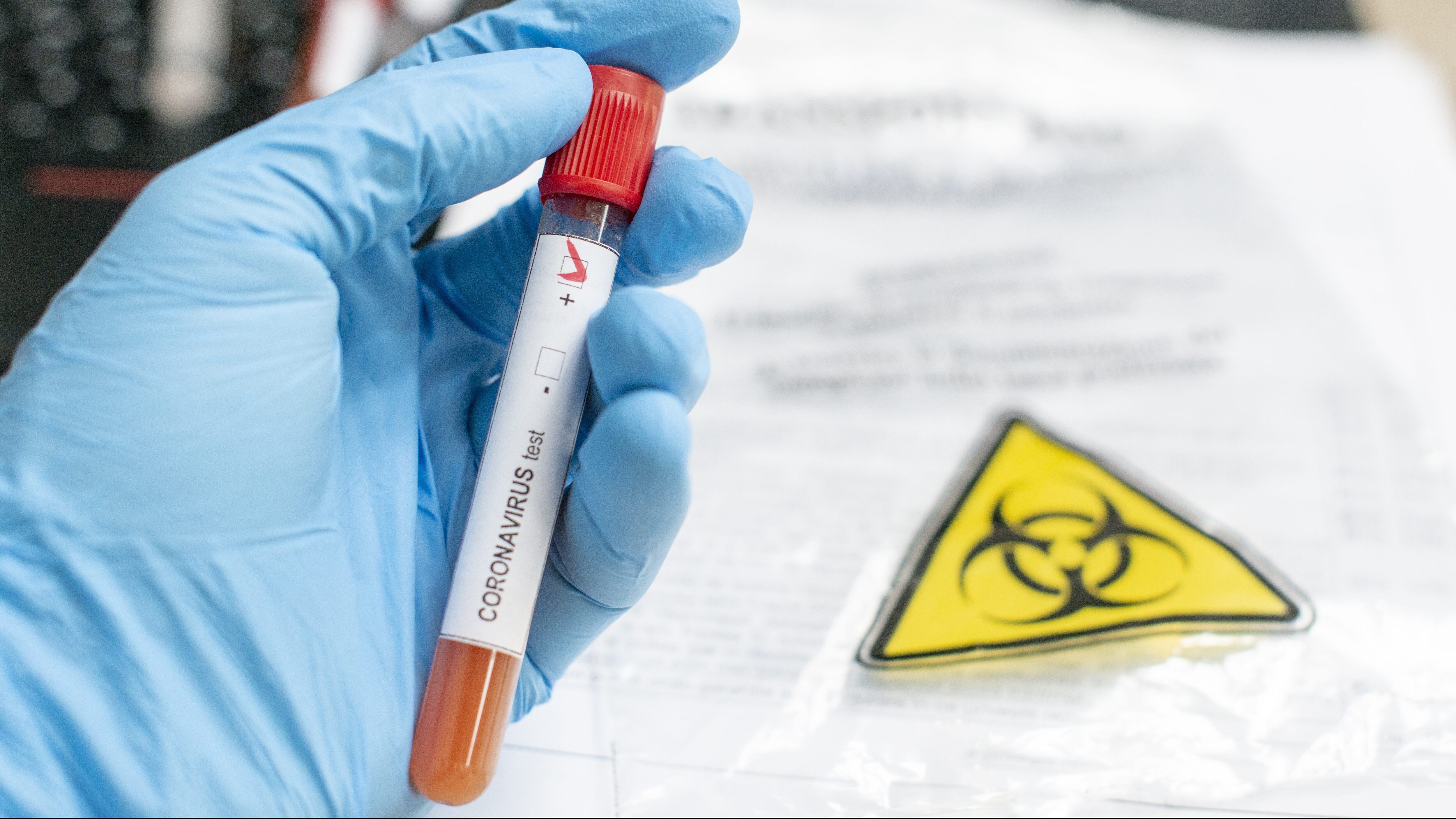 Severe acute respiratory syndrome coronavirus 2  (SARS-CoV-2)