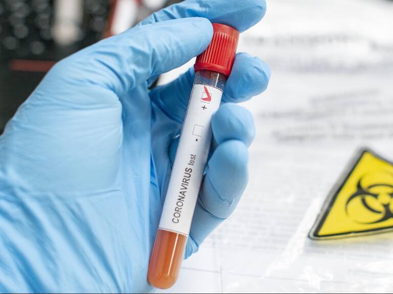 Severe acute respiratory syndrome coronavirus 2 (SARS-CoV-2)