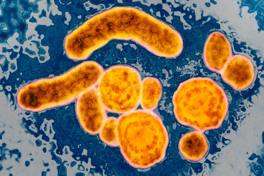 Imagen del virus de la Hepatitis B