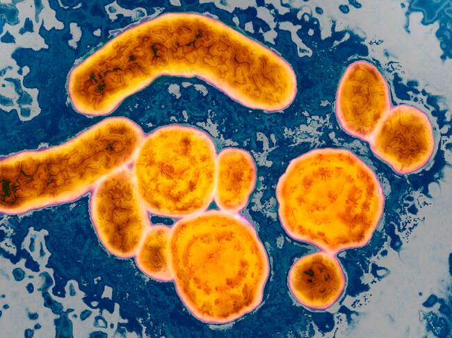 Imagen del virus de la Hepatitis B