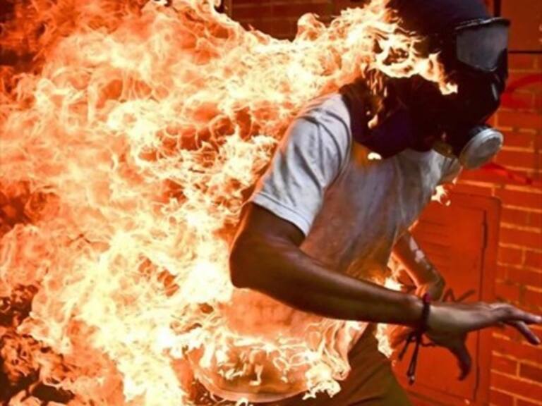 Protagonista de la mejor foto del 2018, tomada durante las protestas en Venezuela, habló sobre Chile