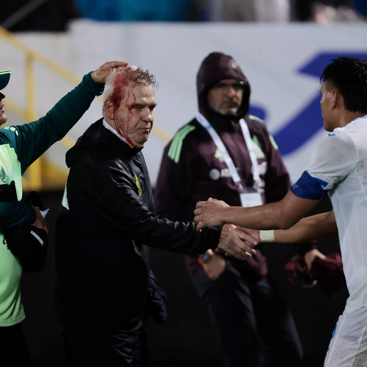 La grave agresión que sufrió el DT de México tras duelo ante Honduras: terminó sangrando y Reinaldo Rueda pidió disculpas
