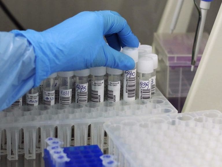 13 DE MAYO DE 2021/VALPARAISOEl Hospital Carlos van Buren inaugura un nuevo Laboratorio de Biología Molecular que fue diseñado e implementado para absorber la gran demanda de procesamiento de exámenes de PCR, entre otras labores, que generó la contingencia sanitaria por Covid-19.
FOTO: LEONARDO RUBILAR CHANDIA/AGENCIAUNO