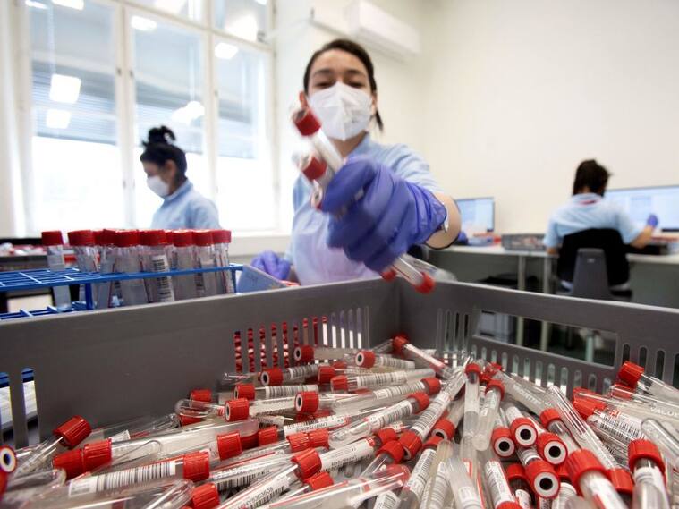Trabajadores de un laboratorio analizan exámenes del covid-19