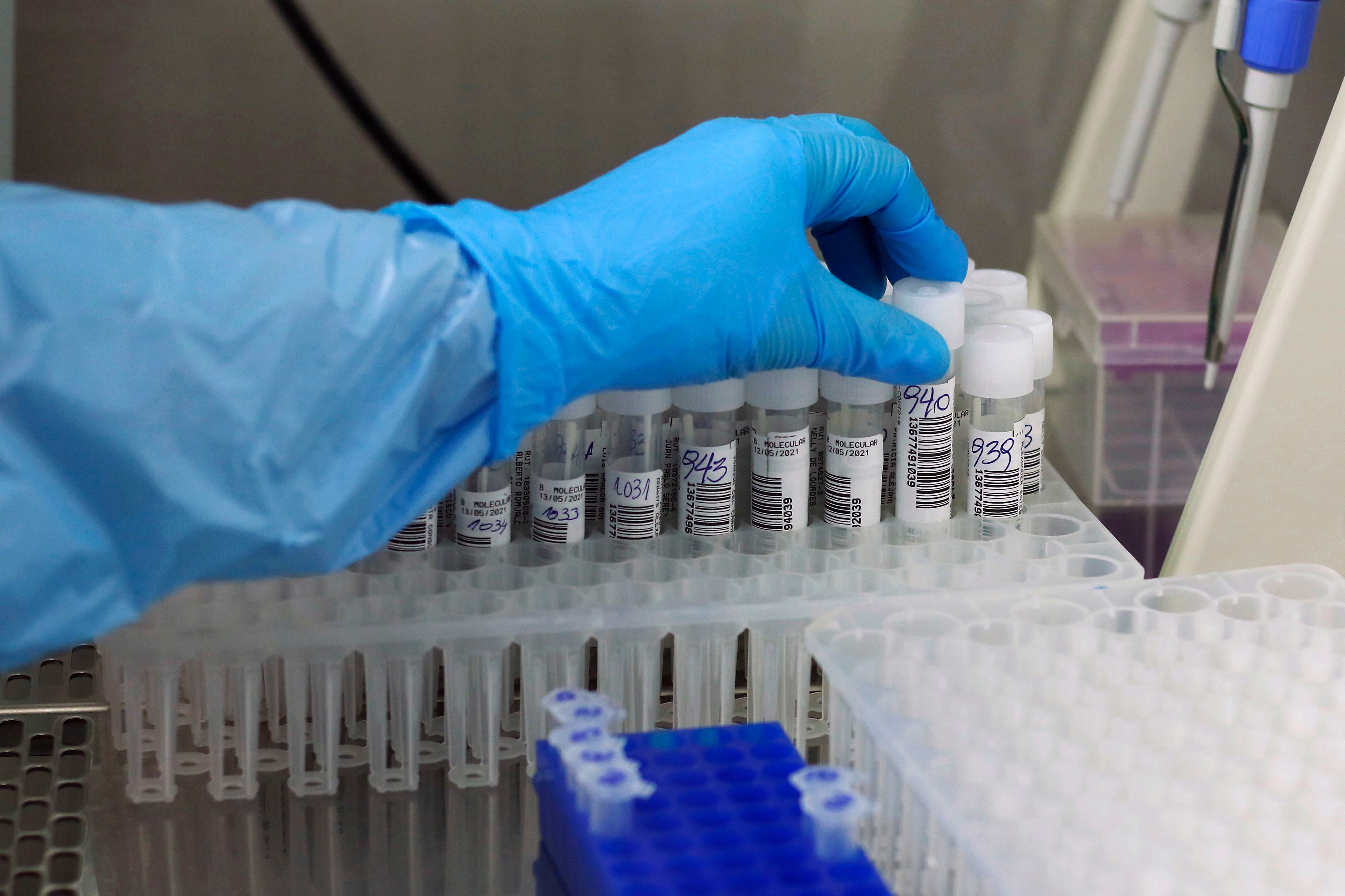13 DE MAYO DE 2021/VALPARAISOEl Hospital Carlos van Buren inaugura un nuevo Laboratorio de Biología Molecular que fue diseñado e implementado para absorber la gran demanda de procesamiento de exámenes de PCR, entre otras labores, que generó la contingencia sanitaria por Covid-19.
FOTO: LEONARDO RUBILAR CHANDIA/AGENCIAUNO