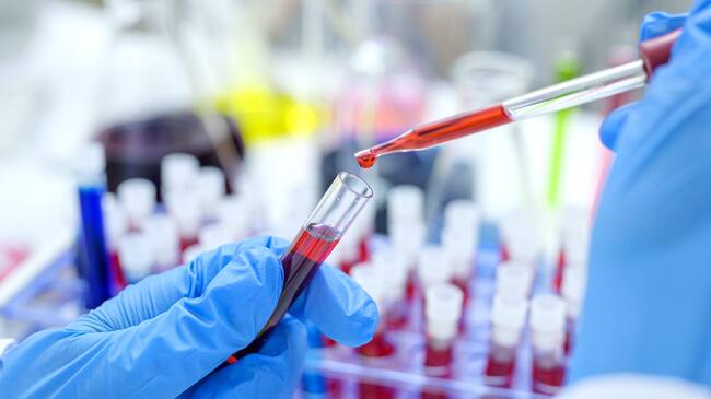 Scientist hand holding test tube with blood in laboratory.