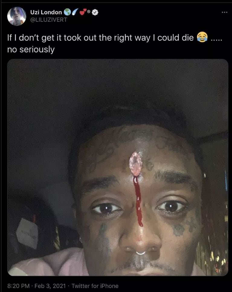 Lil Uzi Vert
