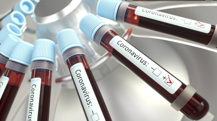 Coronaviruses research, conceptual illustration. Vials of blood in a centrifuge being tested for coronavirus infection.