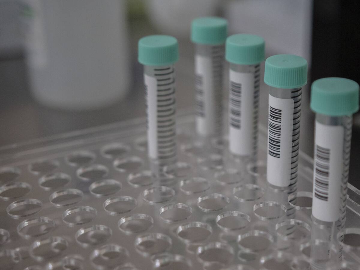 Informe Epidemiológico: se registra leve disminución de casos activos de covid-19 a nivel nacional