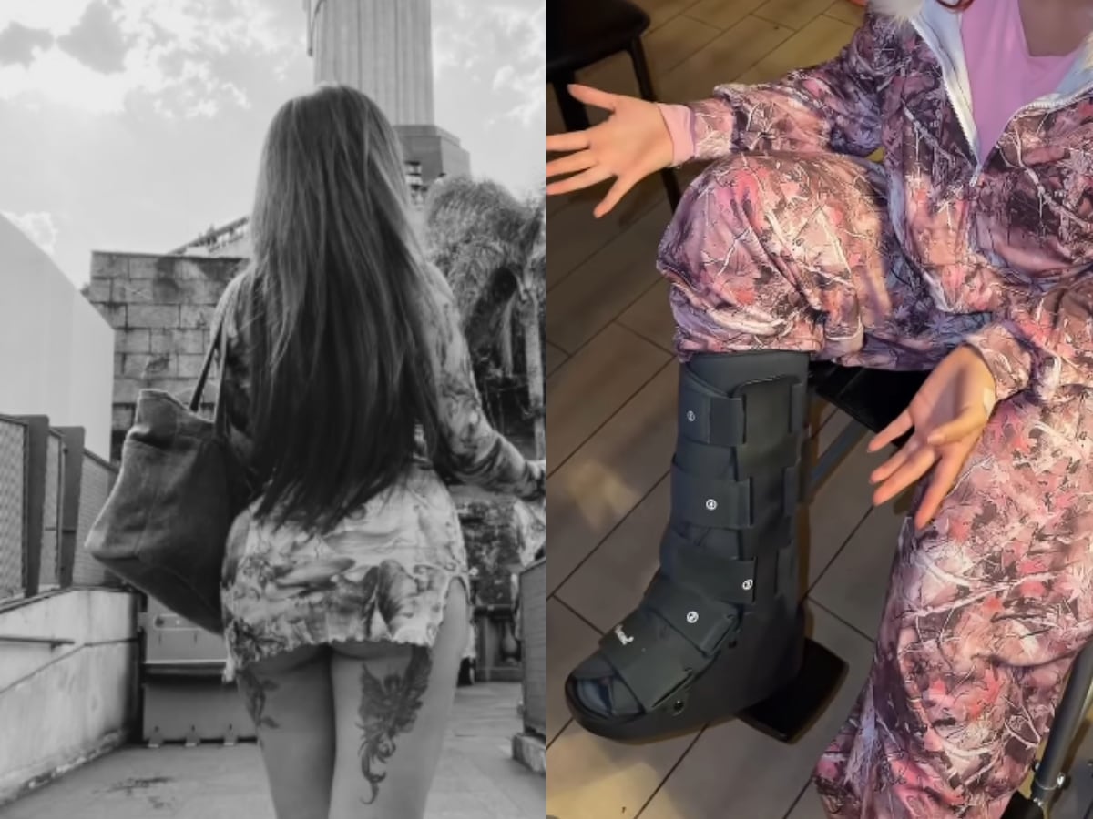 Famosa exchica reality sufre grave accidente en su cumpleaños y deberá operarse: “Terminé en urgencias y en silla de ruedas”