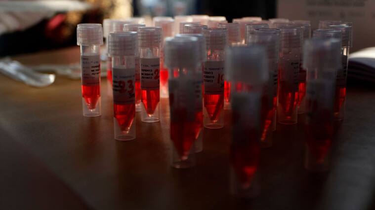 BEKASI, INDONESIA - MAY 05, 2020 - Medical workers collecting a swab sample from commuter line passengers for polymerase chain reaction (PCR) test to determine COVID-19 infections at Bekasi train station in Bekasi, West Java, Indonesia on May 5, 2020. (Melvinas Priananda)- PHOTOGRAPH BY Jefta Images / Barcroft Studios / Future Publishing (Photo credit should read Jefta Images/Barcroft Media via Getty Images)