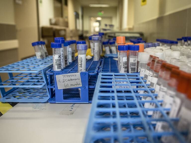 Exámenes PCR por covid-19 en Chile