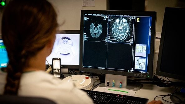 Así funciona el método chileno que busca reducir las secuelas de un accidente cerebrovascular