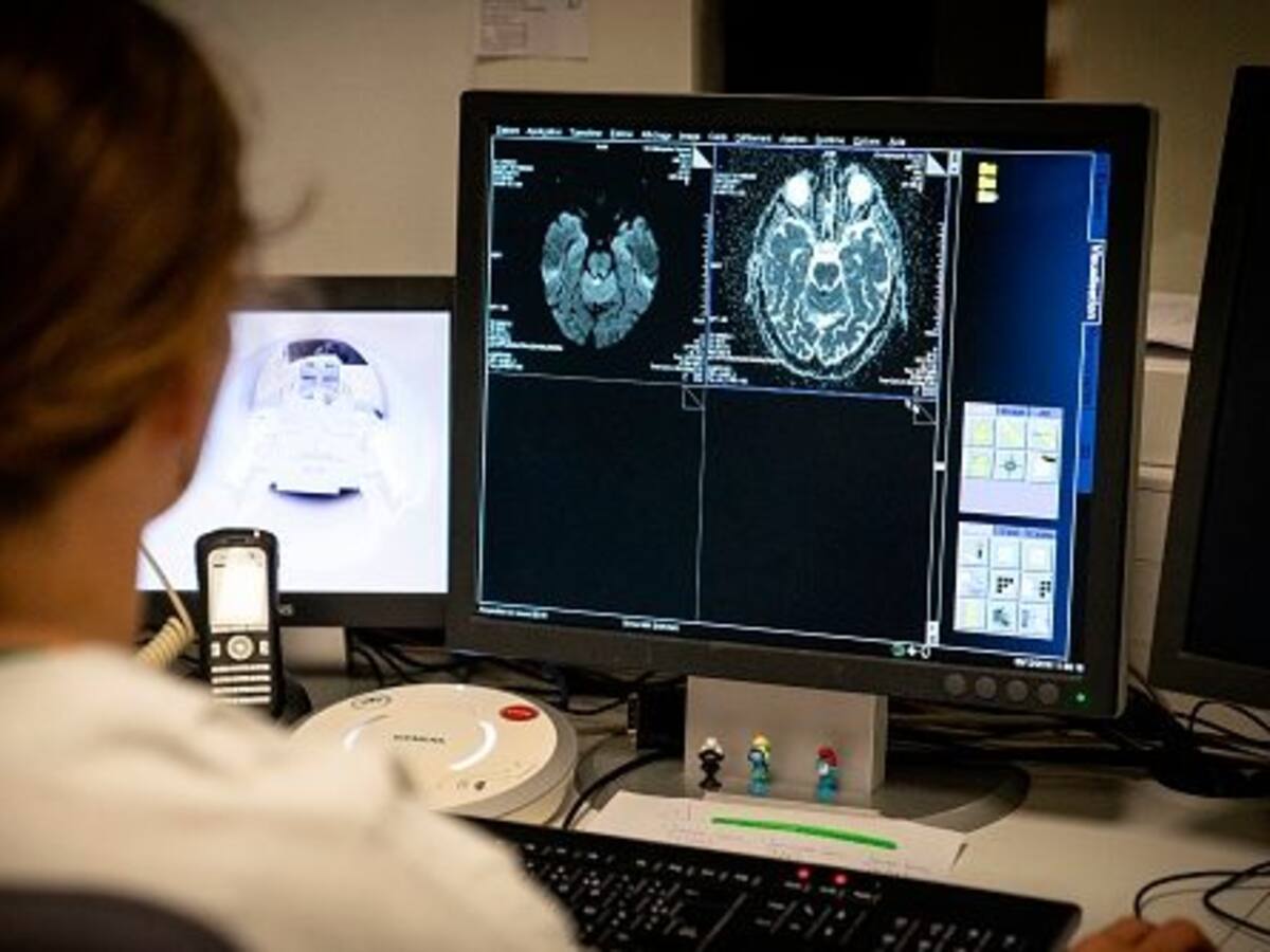 Así funciona el método chileno que busca reducir las secuelas de un accidente cerebrovascular