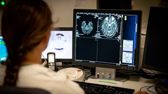 Así funciona el método chileno que busca reducir las secuelas de un accidente cerebrovascular