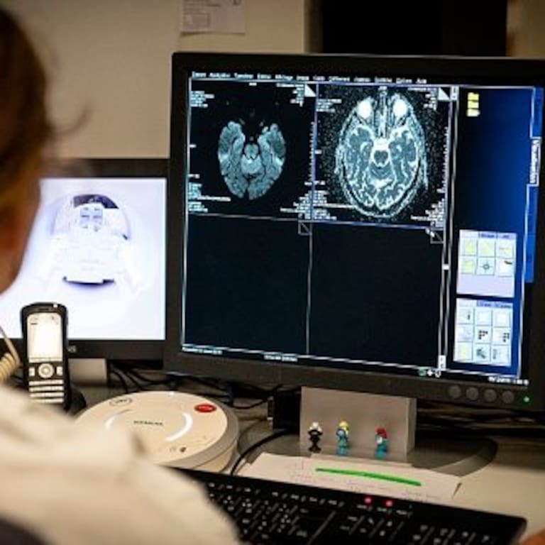 Así funciona el método chileno que busca reducir las secuelas de un accidente cerebrovascular