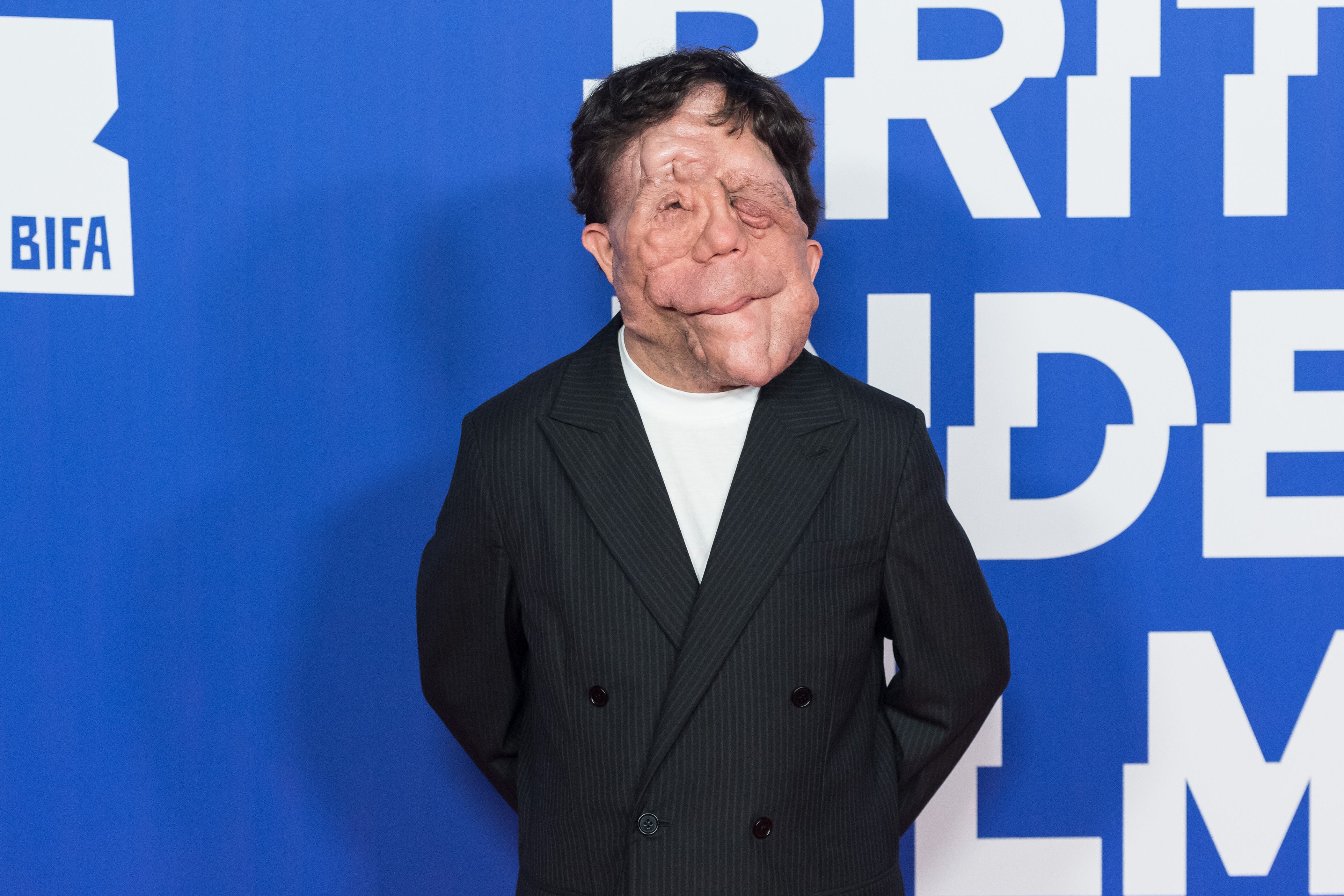 Getty Images