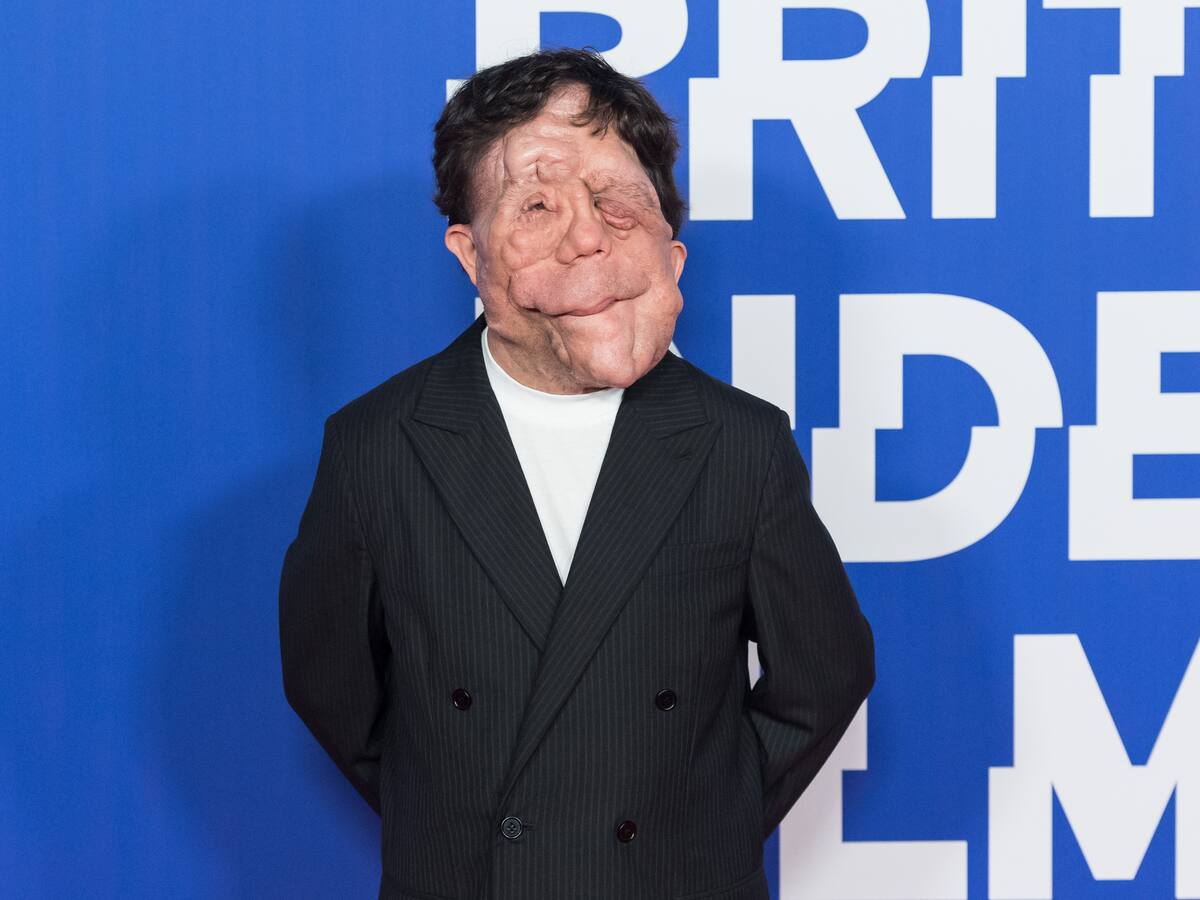 Quién es Adam Pearson, la nueva estrella atípica de Hollywood y protagonista de una de las mejores películas del último año