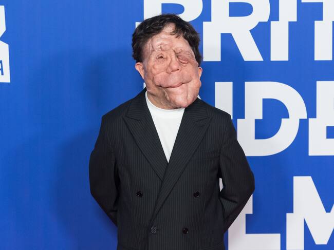 Getty Images