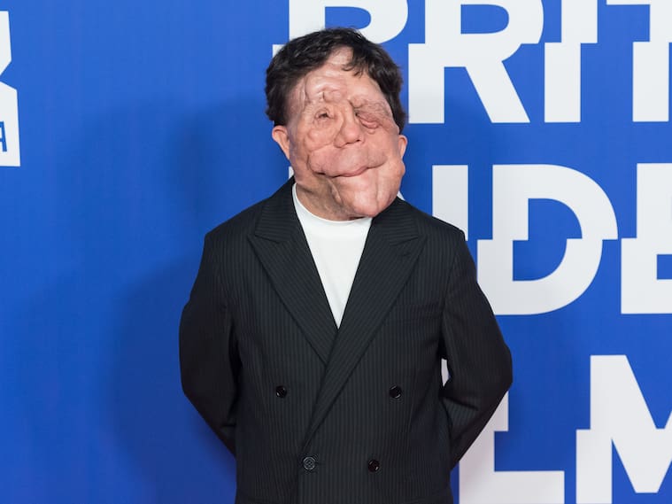Getty Images