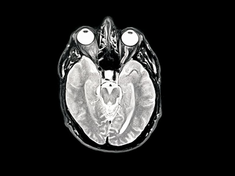 LONDON, ENGLAND - MAY 30 (Photo by Peter Dazeley/Getty Images)