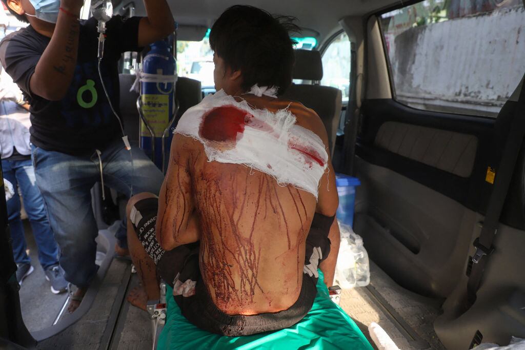 Manifestante herido por la violencia policial en Mandalay