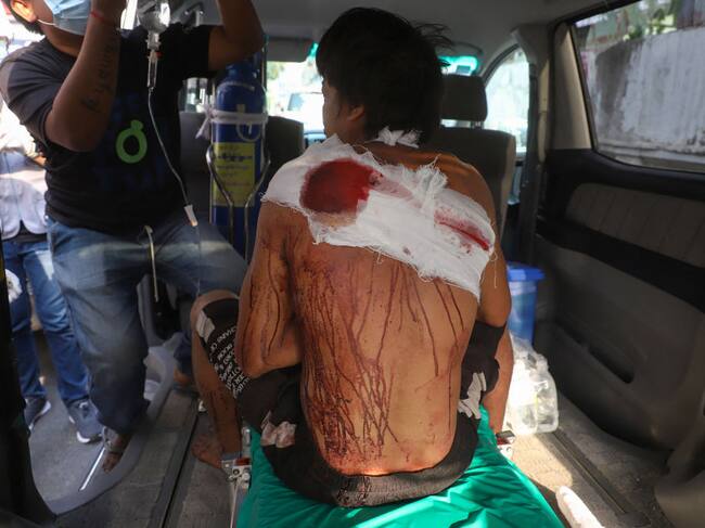 Manifestante herido por la violencia policial en Mandalay