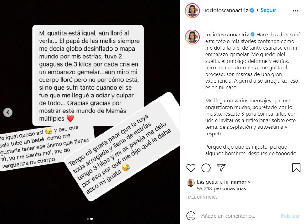 Captura | Rocío Toscano muestra foto de su abdomen después del embarazo para entregar potente mensaje