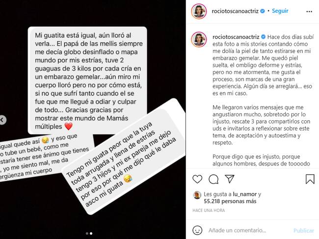 Captura | Rocío Toscano muestra foto de su abdomen después del embarazo para entregar potente mensaje