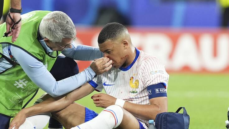 ¿Podrá volver a jugar? DT de Francia aclara el estado de Kylian Mbappé tras su fractura de nariz en la Eurocopa
