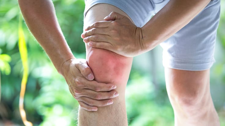 Nueva técnica promete regenerar el cartílago dañado por la artrosis y evitar prótesis de rodilla