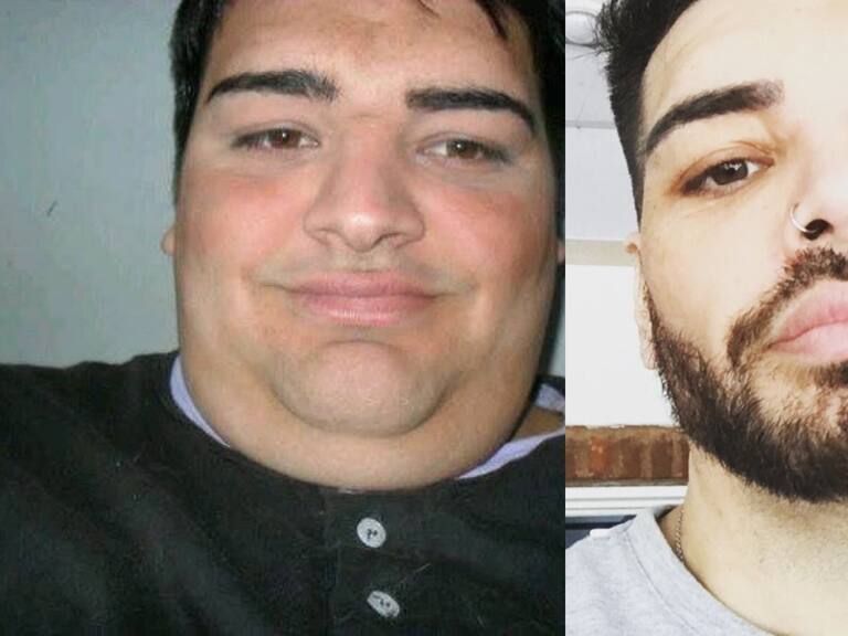 Argentino ex «Cuestión de peso» se operó 28 veces para ser como Ricky Martin