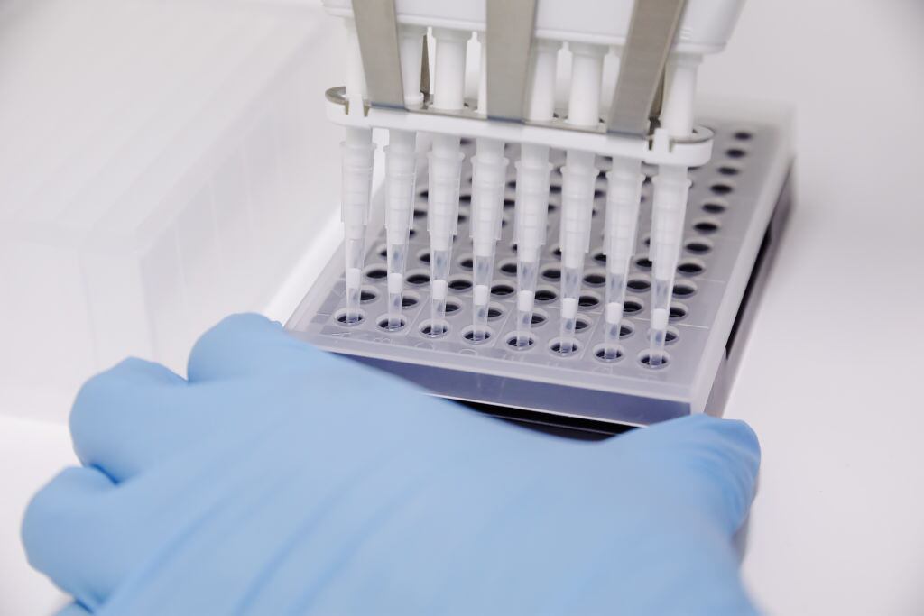 Laboratorio revisa test para detectar contagios de la viruela del mono