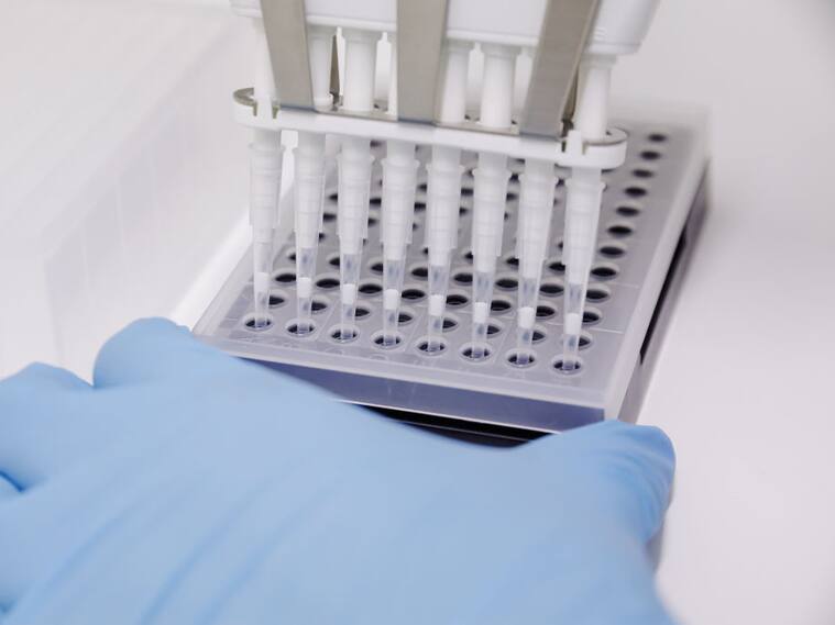 Laboratorio revisa test para detectar contagios de la viruela del mono