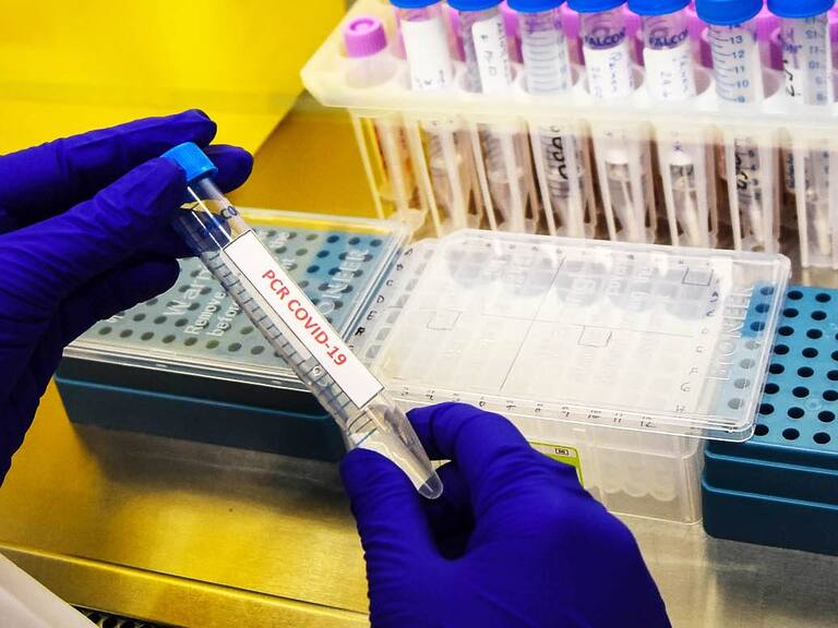 24 DE SEPTIEMBRE 2020 / TEMUCOTecnólogo Médico del Laboratorio del Hospital Regional Hernán Henríquez Aravena de Temuco, trabaja con muestras de exámenes PCR por COVID-19.
FOTO: ROCIO CUMINAO ROJAS / AGENCIAUNO