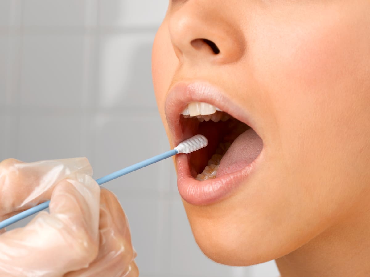 Nuevo test de saliva podría revolucionar la detección del cáncer de próstata, según estudio