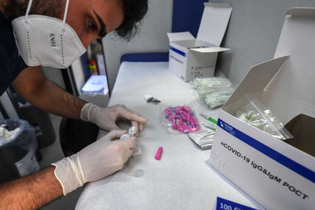 Trabajador médico revisa exámenes del Covid-19 en Nápoles
